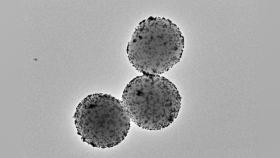 Imagen de microscopía electrónica de transmisión de los nanorrobots.