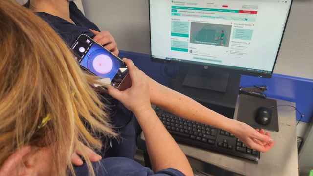 El nuevo servicio de Teledermatología de Quirónsalud permite diagnosticar melanomas en fase inicial
