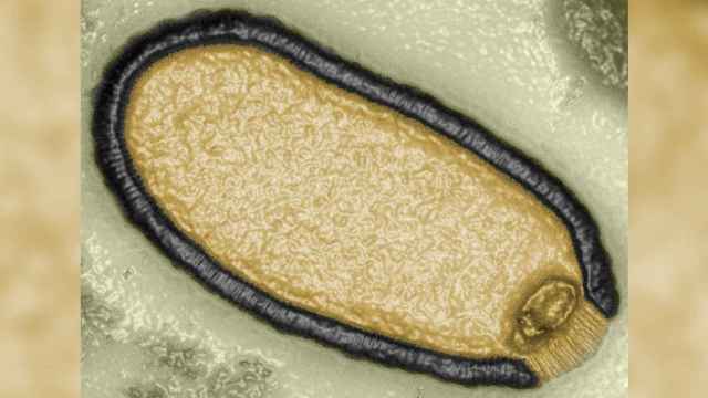 Imagen de una ameba infectada por el virus.