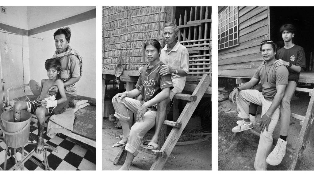 Sokheurm Man, herido en 1996 y en 2007 junto a su padre y en 2023 junto a su hijo Enero / Foto: Gervasio Sánchez.