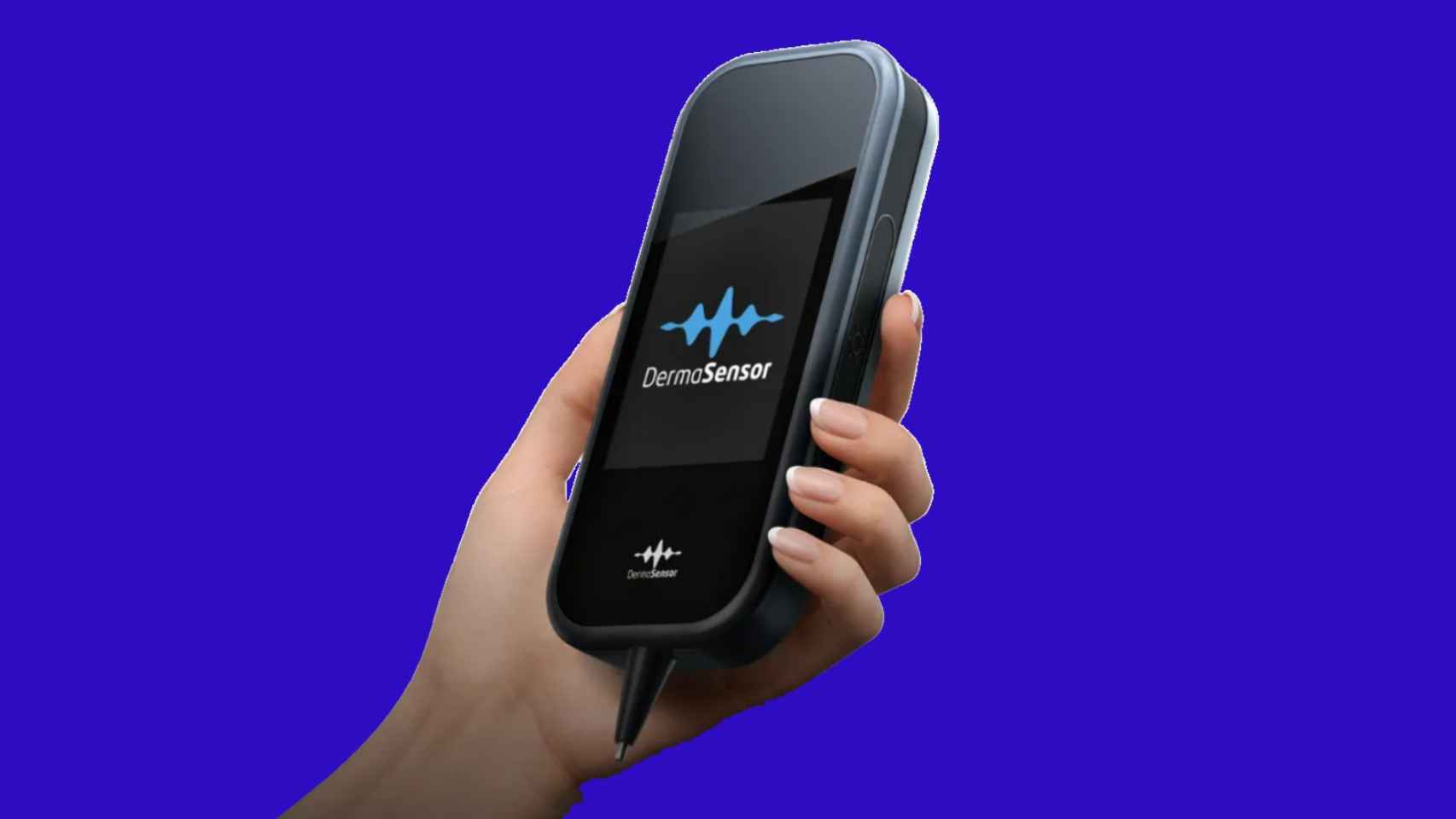 El dispositivo DermaSensor tiene el tamaño de un teléfono móvil