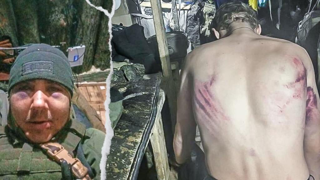 A este combatiente le golpearon sus propios mandos. Su nombre es Meshkov Evgeniy Valerievich, soldado del grupo de asalto“Storm V”, unidad militar 30926. Sirve en Volnovaja.