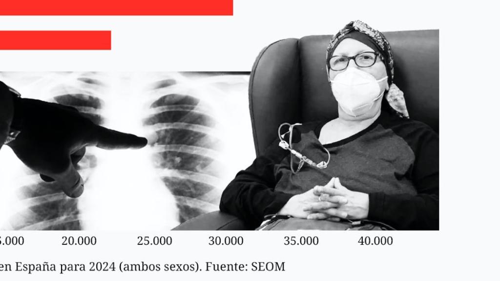 Estimación de nuevos casos de cáncer para 2024.
