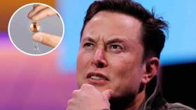 Elon Musk ha anunciado que su empresa Neuralink ha implantado su primer chip en un cerebro humano.