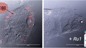 Investigadores de la USC y el CSIC desarrollan un nuevo compuesto que actúa sobre las células madre cancerígenas.