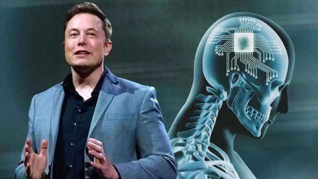 Del MK-Ultra al chip de Elon Musk: por qué te tienen que importar tus neuroderechos