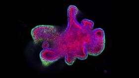 Vista de un organoide de cáncer al microscopio. Imagen: Karsten Boehnke/Lilly.