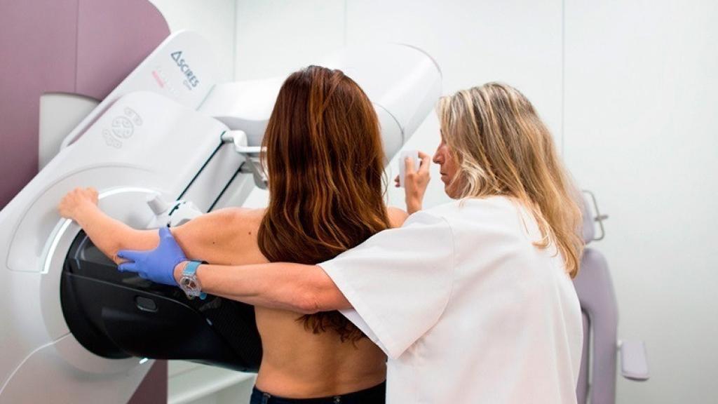 Imagen de una mamografía.