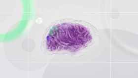 Cerebro. Imagen: Pexels/Google DeepMind