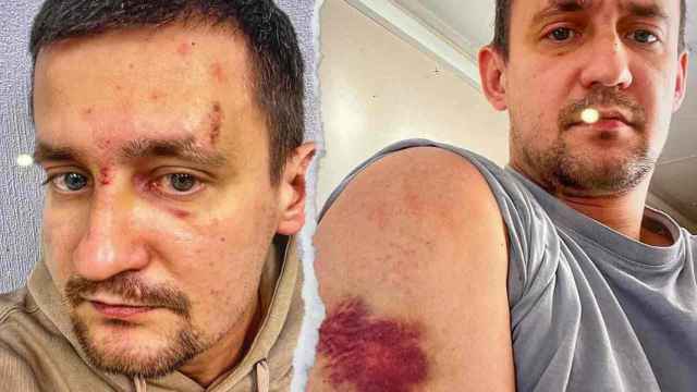 Un ex policía ruso retenido en El Prat pide asilo a España: fue torturado y se negó a servir en Ucrania