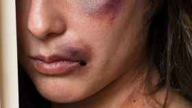 Imagen de archivo del rostro de una mujer con heridas tras sufrir violencia de género.