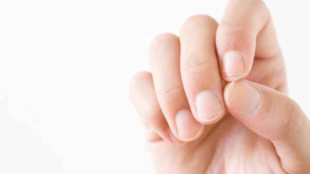 La onicosquicia es un problema en las uñas que lo padecen entre el 27% y el 35% de la población española.