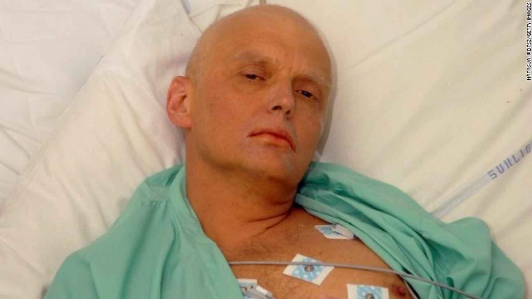 El espía Alexander Litvinenko.