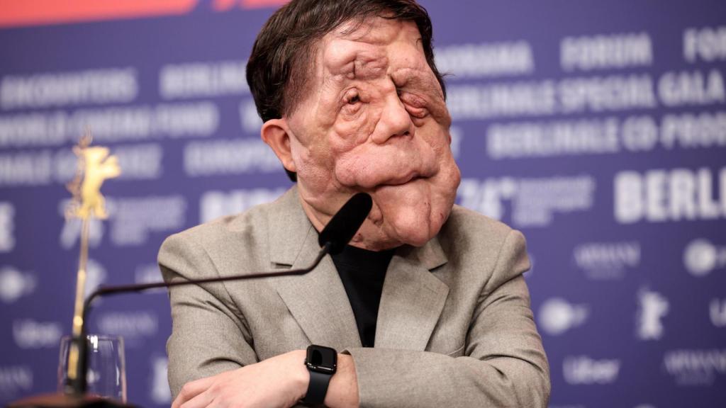 Adam Pearson, protagonista de 'A different man', en la 74ª edición del Festival de Berlín. Foto: EFE/EPA/CLEMENS BILAN