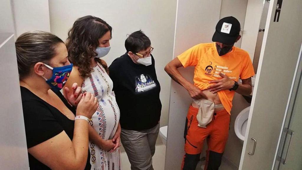 Un paciente ostomizado muestra la bolsa que lleva en su abdomen.