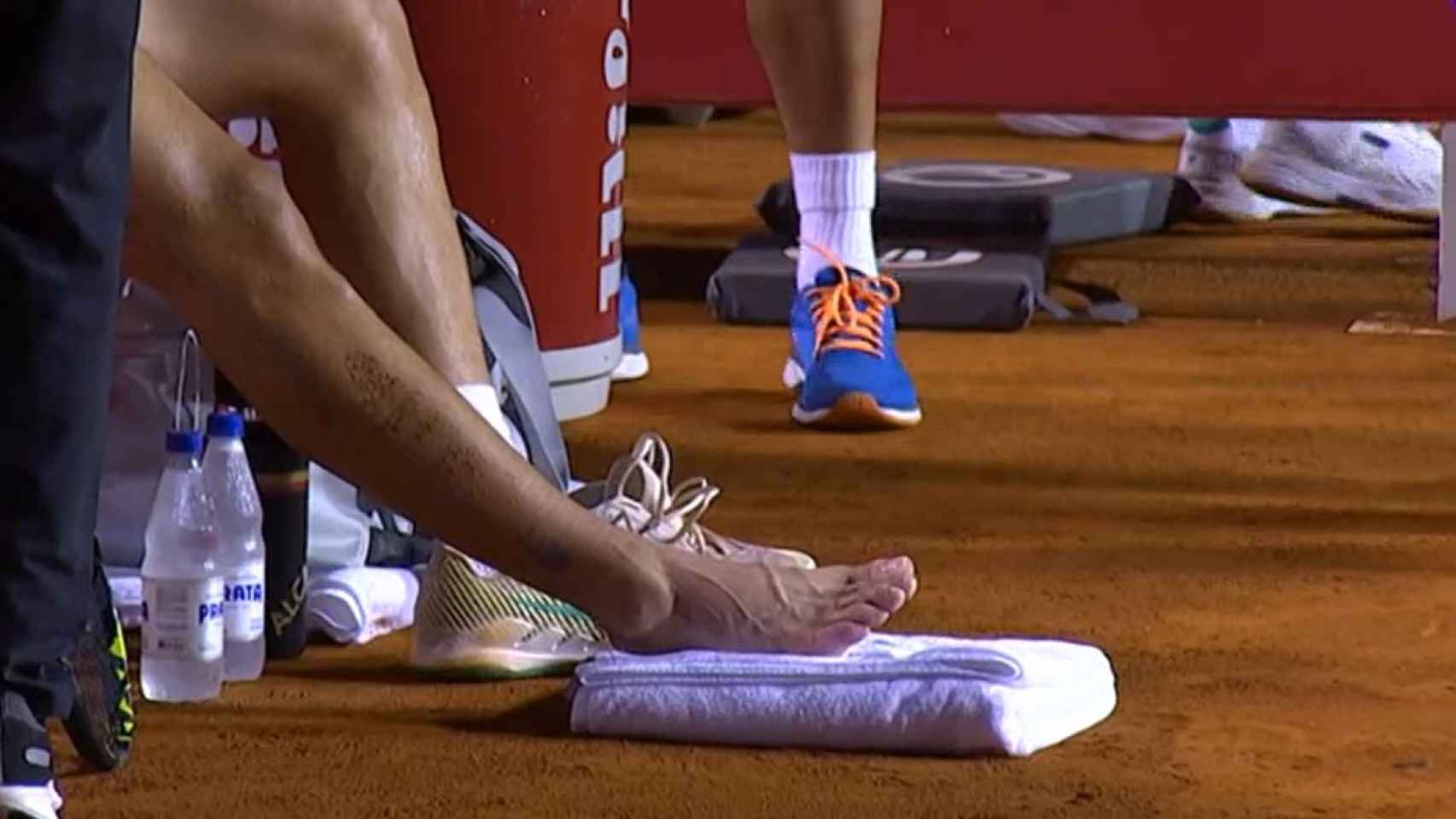 Así quedó el tobillo derecho de Carlos Alcaraz tras su lesión en Río de Janeiro