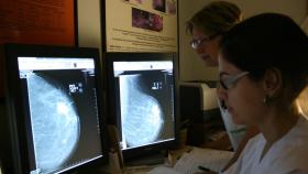 Imagen de archivo del análisis de una mamografía.