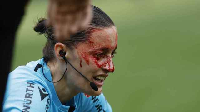 La asistente Guadalupe Porras, con la cara llena de sangre.