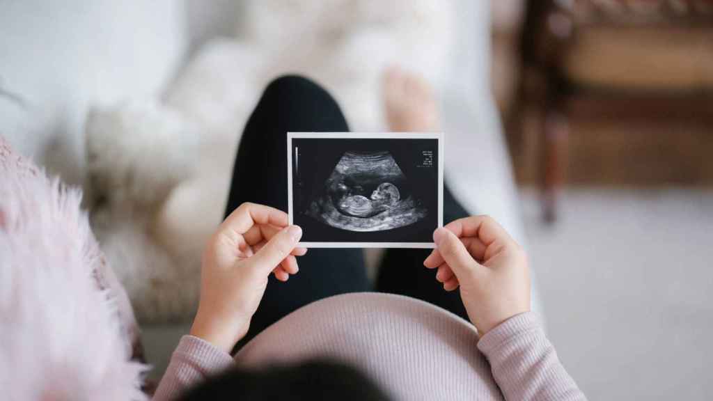 Una mujer embarazada mira la ecografía de su bebé.
