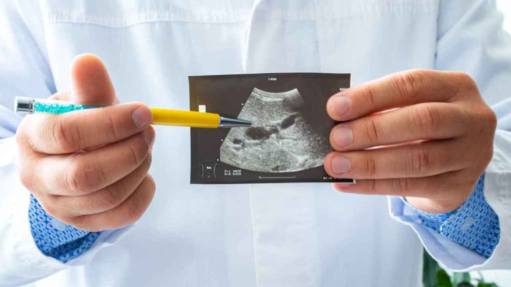 Un doctor mostrando una ecografía de una paciente embarazada.