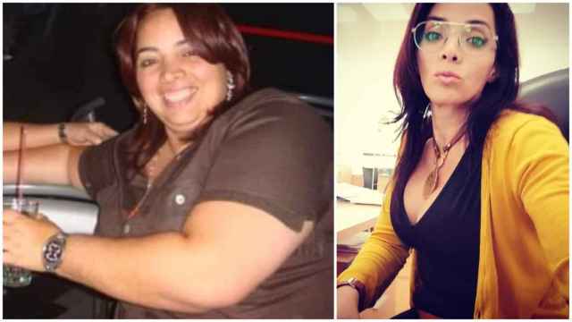 Ana Gorrín llegó a pesar 140 kilos. Actualmente, se mantiene en los 63 kilos tras someterse a una cirugía beriátrica.
