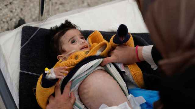 Ahmed Qannan, un niño palestino que vive en la Franja de Gaza, siendo atendido en un centro de salud al sufrir malnutrición.