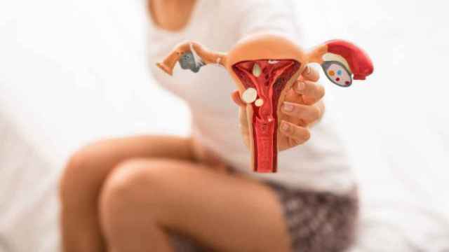 La endometriosis, una enfermedad silenciada que afecta a un 10% de mujeres en el mundo