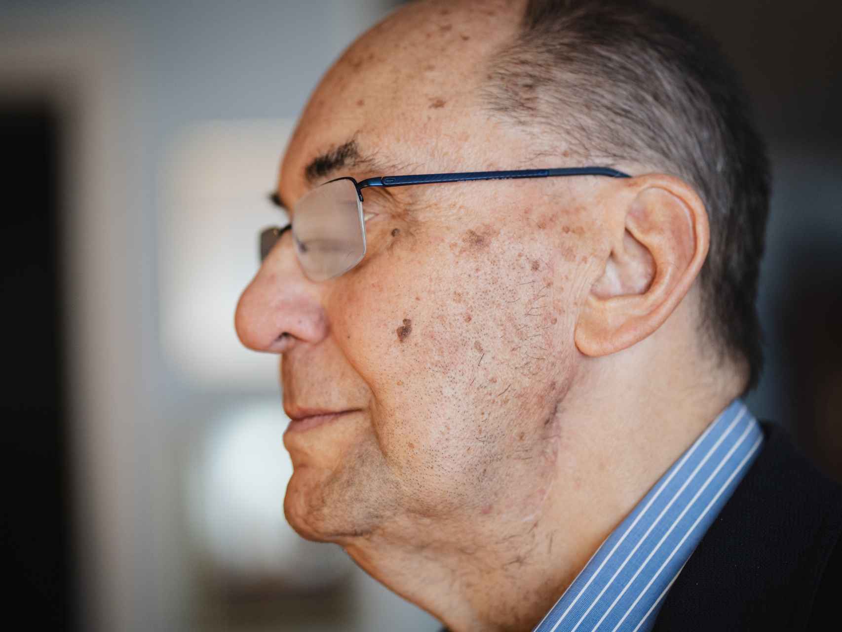 La cicatriz en el cuello de Vidal-Quadras fruto de la salida de la bala. Apenas perceptible gracias al trabajo del hospital Gregorio Marañón.