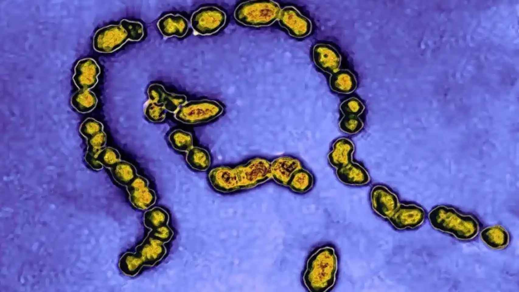 なぜ一般的な細菌が大惨事を引き起こすのか