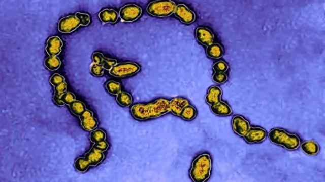 El estreptococo A es una infección bacteriana que puede llegar a ser muy grave.