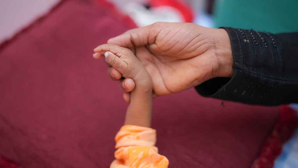 Una madre sujeta la mano de su hija de 7 meses en estado de malnutrición.