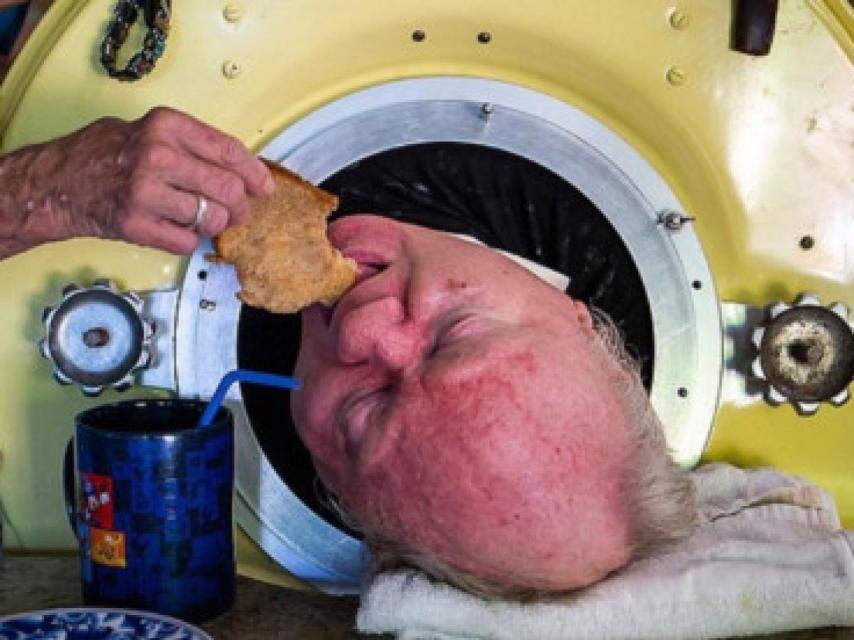 Paul Alexander necesitaba ayuda para realizar cualquier acción cotidiana, como comer.