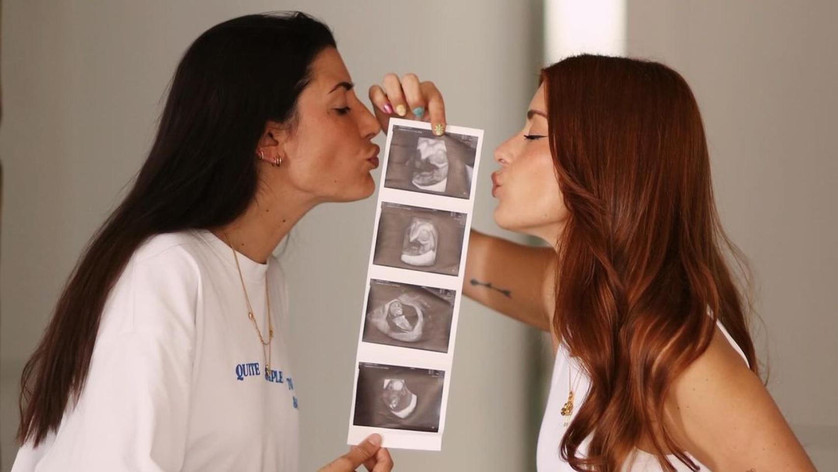 Dulceida, embarazada de su primer hijo junto a Alba Paul: "Tus mamis te esperan con muchas ganas"