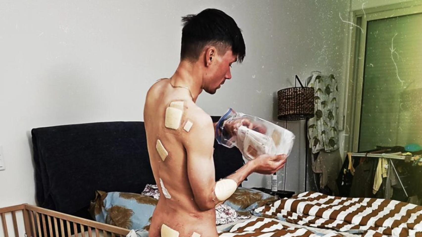 Primoz Roglic muestra sus heridas tras la Itzulia