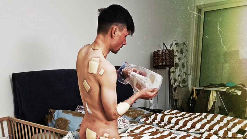 Primoz Roglic muestra sus heridas tras la Itzulia