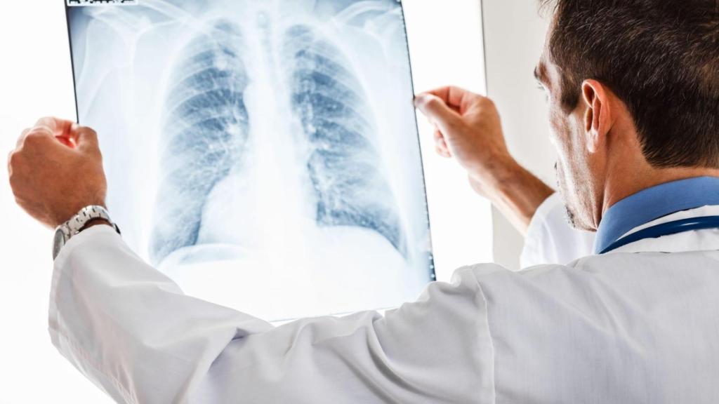 Médico con una radiografía pulmonar