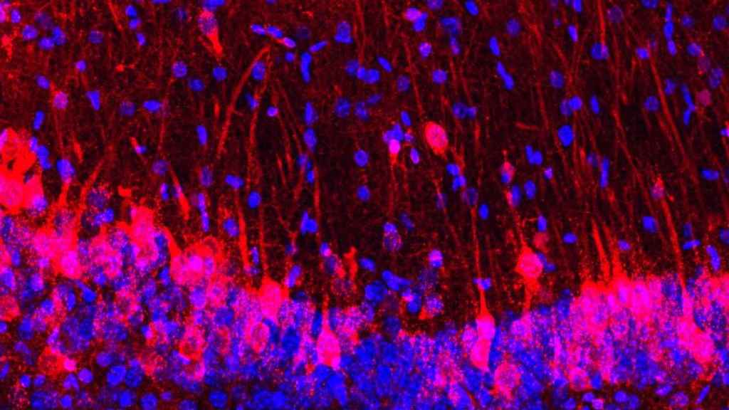 Neuronas del hipocampo de ratón (azul) entremezcladas con las de rata (rojo).