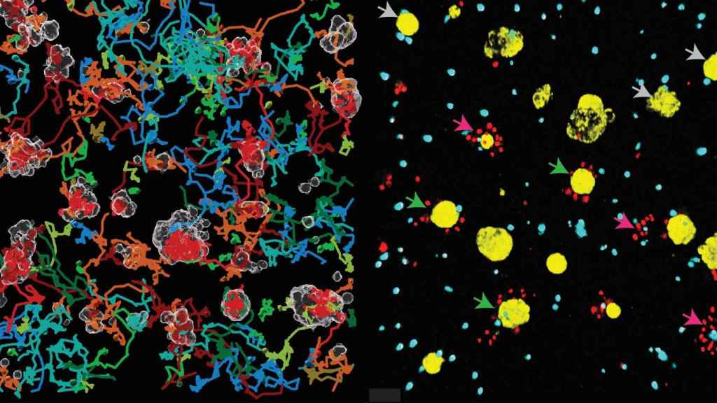 'BEHAV3D' permite entender cómo se comportan las células inmunes contra los tumores.