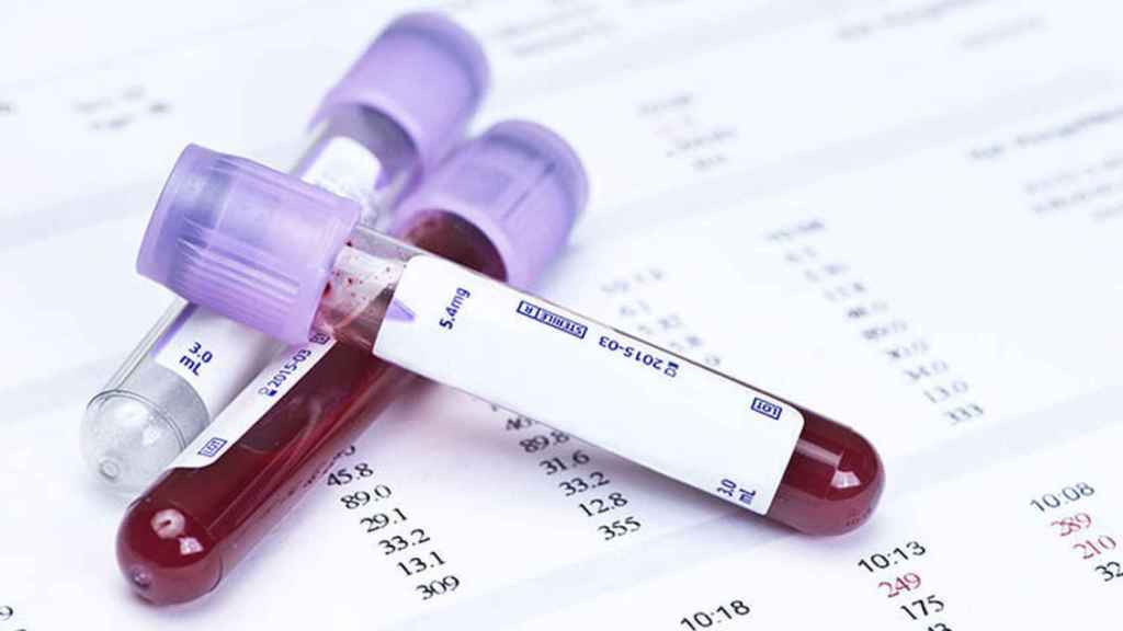 Detectar el cáncer con un análisis de sangre es algo que los científicos llevan años intentando.