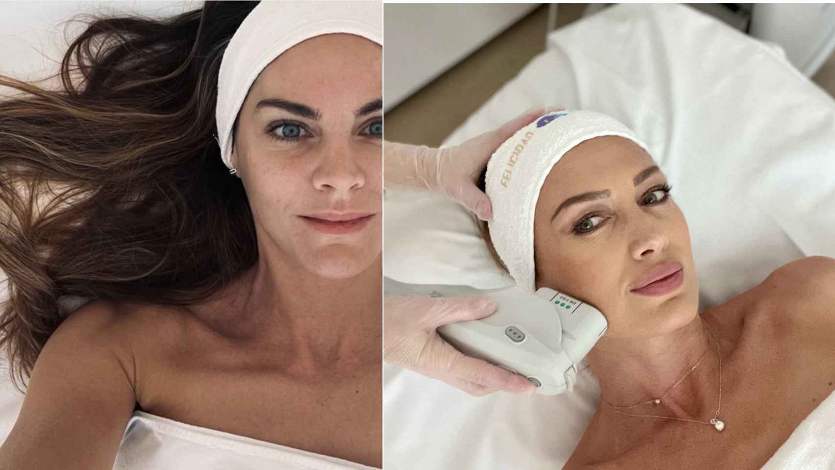 Amaia Salamanca y Nieves Álvarez en su cita anual con el tratamiento Ultherapy.