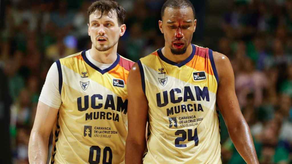 Yannis Morin, del UCAM, con la cara ensangrentada.