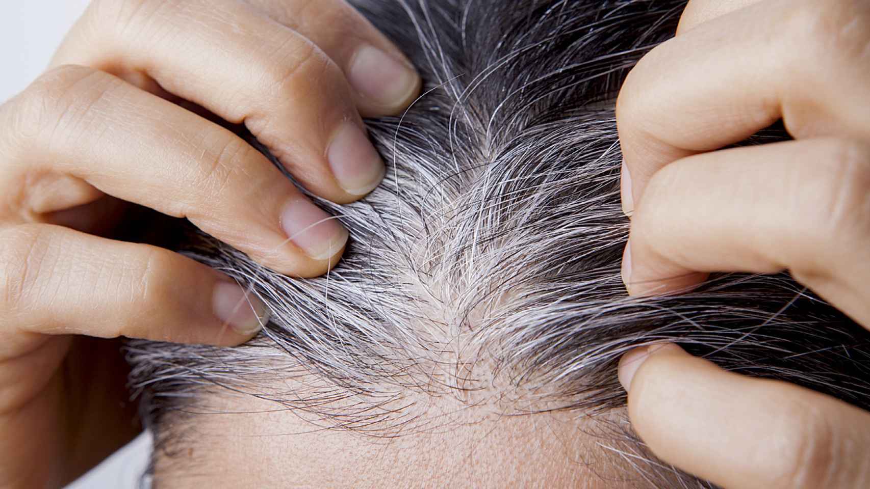 Persona con el cabello repleto de canas.