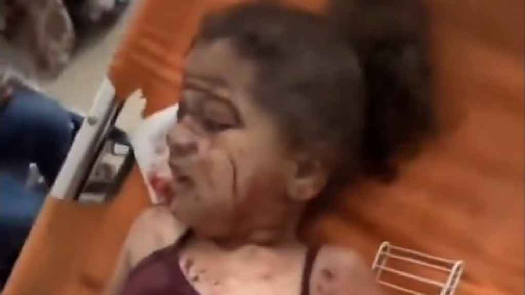 Imagen de una niña palestina herida grave tras el segundo ataque de Israel contra una escuela de la ONU en 24 horas.