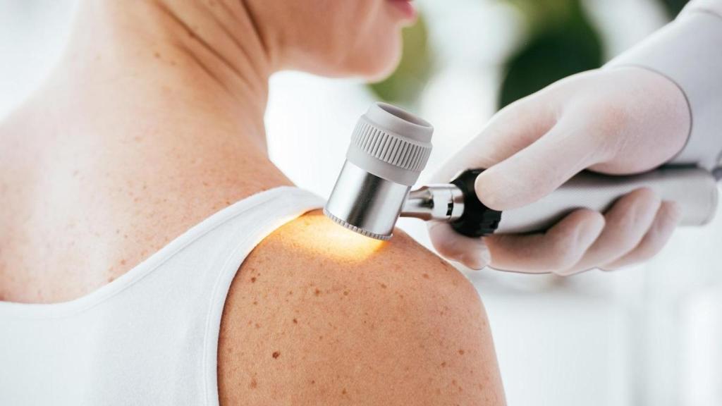 Una paciente se somete a pruebas para la detección del cáncer de piel.