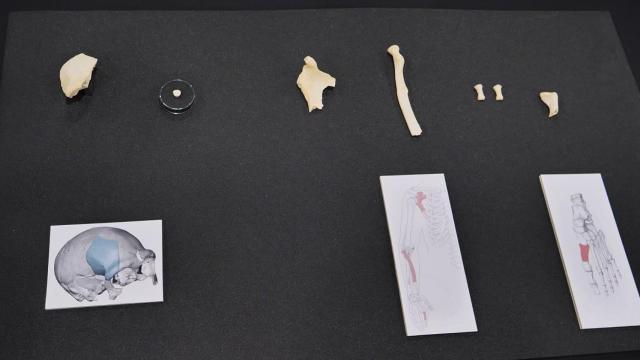 Fragmentos de hueso del neandertal hallado en Karrantza.