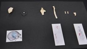 Fragmentos de hueso del neandertal hallado en Karrantza.