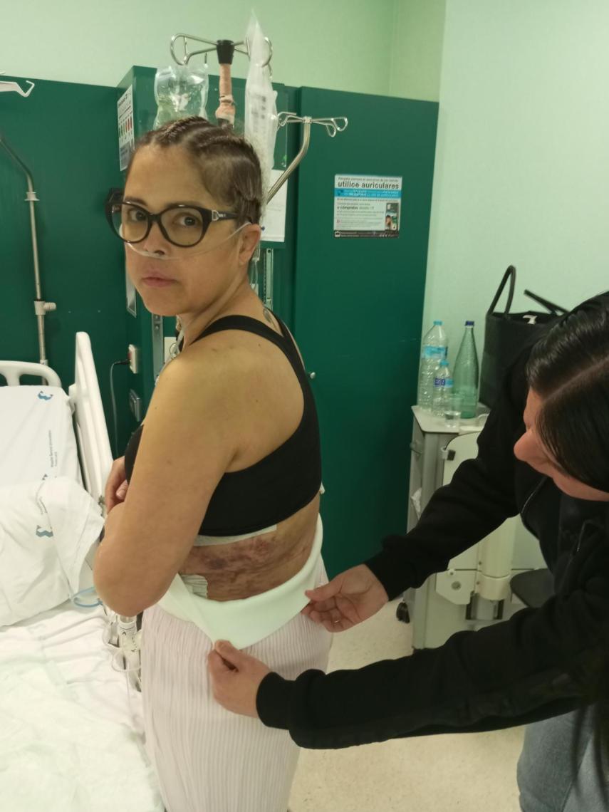 Yngrid mostrando las secuelas de la operación de cirugía estética a la que se sometió el 15 de junio en el Hospital Virgen de la Caridad de Cartagena.
