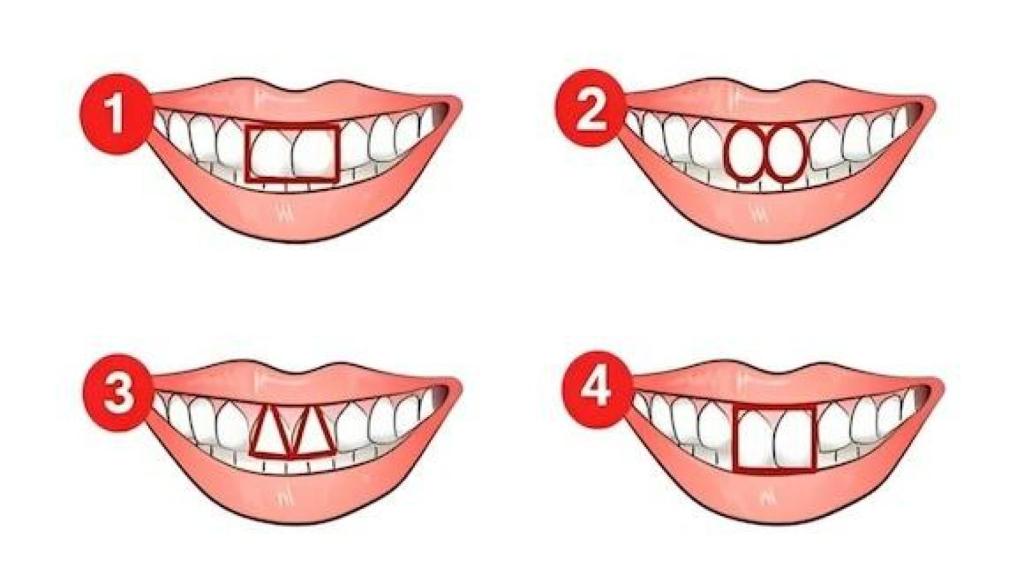 Descubre cuál es tu principal característica de acuerdo a la forma de tus dientes.