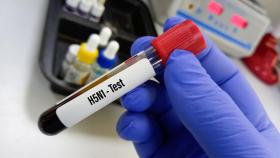 Muestra para las pruebas de la influenza H5N1.