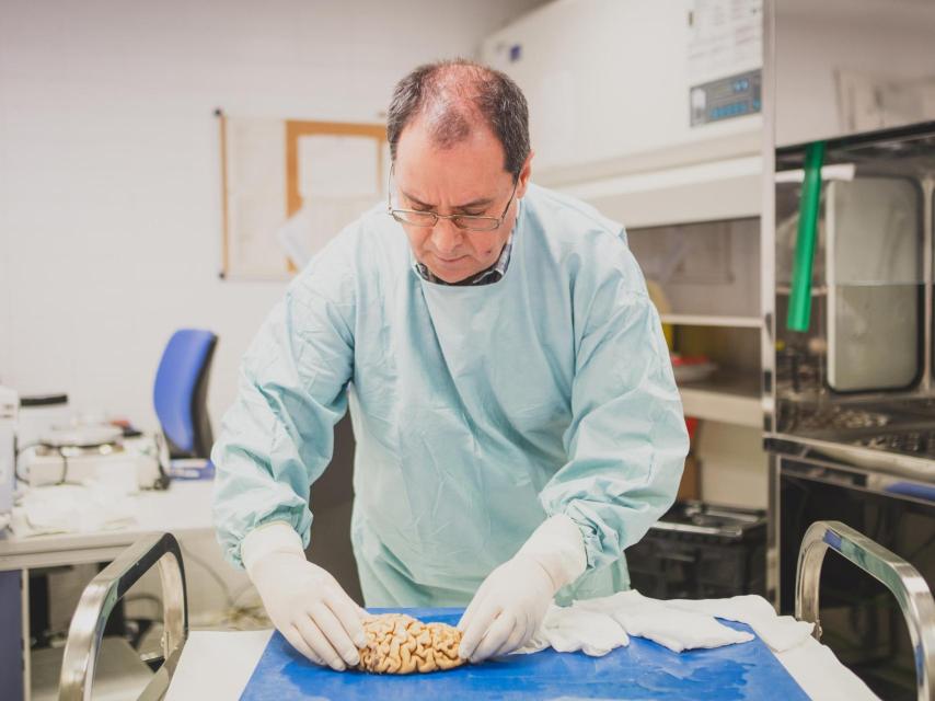 El patólogo Alberto Rábano observa un cerebro humano en el Banco de Tejidos de la Fundación CIEN.